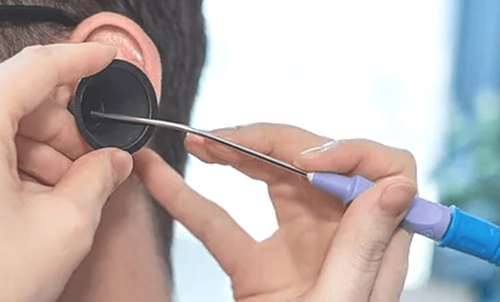 Audiologist Performing Ear Wax Suction - Candid Hearing, Australia